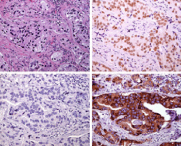 Microscopic tissue samples with different stains.