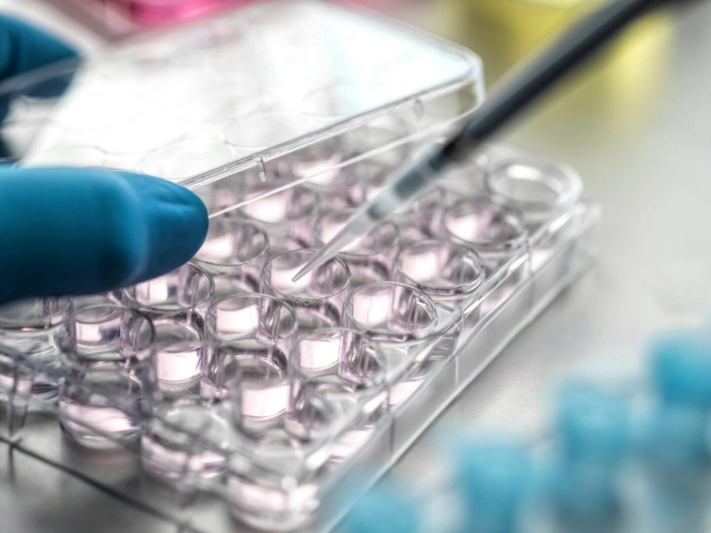 Close-up view of a scientist carefully working with a pipette and a multi-well plate in a lab.